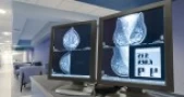 Breast Radiology