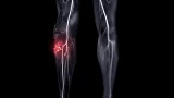 Arterial and Venous Malformation Evaluation and Management