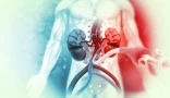 Peripheral Arterial Disease Evaluation and Management