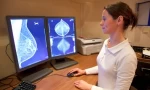 Breast Radiology