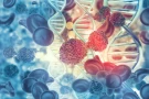 Interventional Oncology